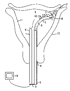 Une figure unique qui représente un dessin illustrant l'invention.